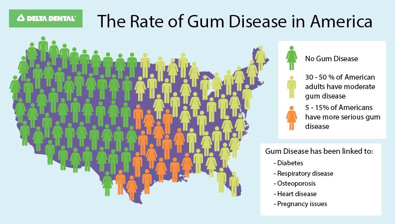 UnitedStates_Gum Disease