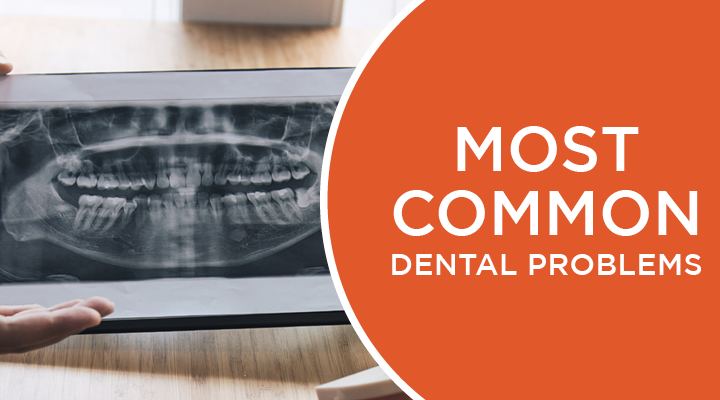 Learn about some of the most common dental problems people have and ways to prevent them.