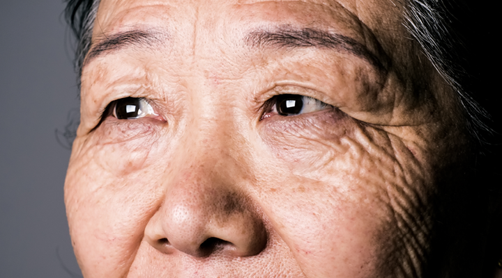 A close up of an older adult's face, including their eyes and nose.