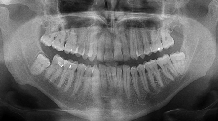 What Does the Future of Dental Care Look Like?